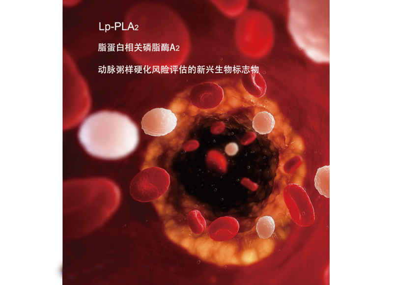 Lp-PLA2----動(dòng)脈粥樣硬化斑塊穩(wěn)定性的評(píng)估標(biāo)志物